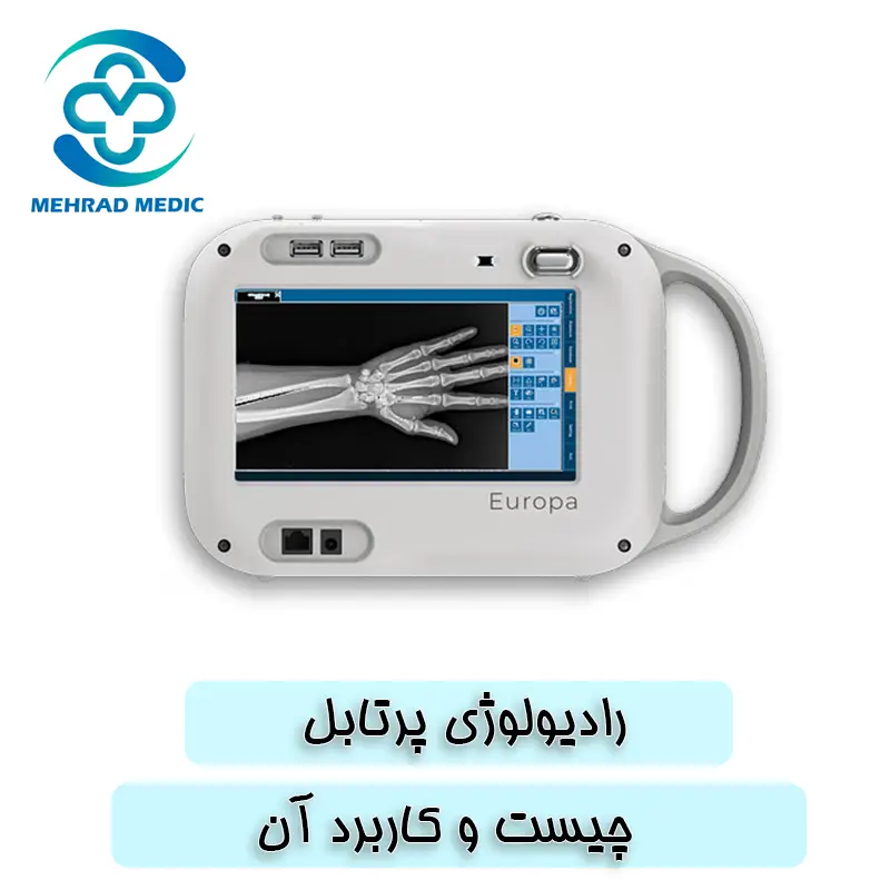 رادیولوژی پرتابل